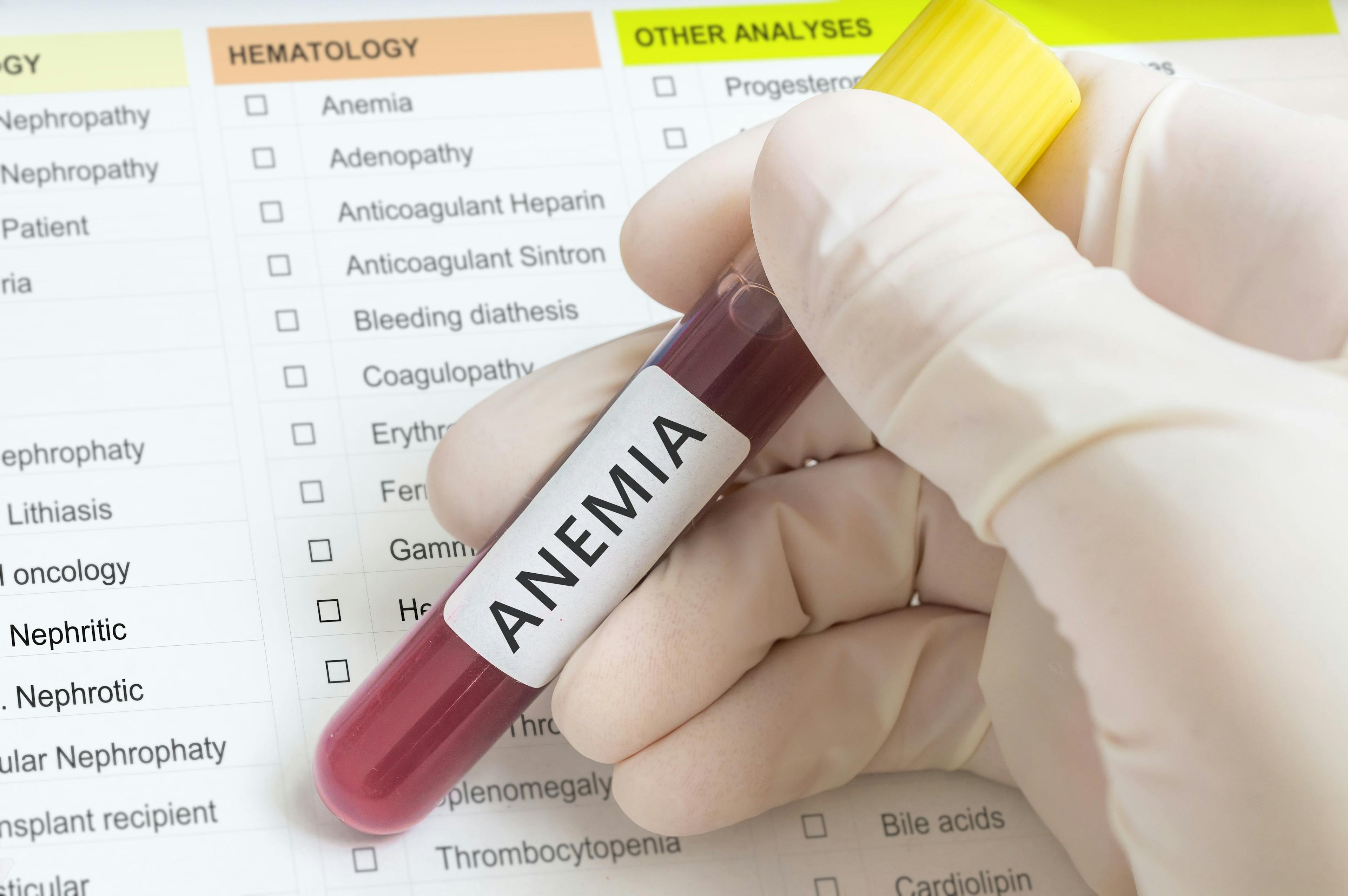 Anemia label on blood test | Image Credit: vchalup – stock.adobe.com
