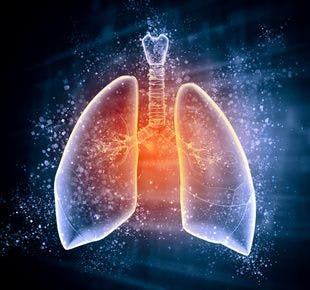 FDA Approves Arikayce to Treat Certain Patients With Rare Lung Disease