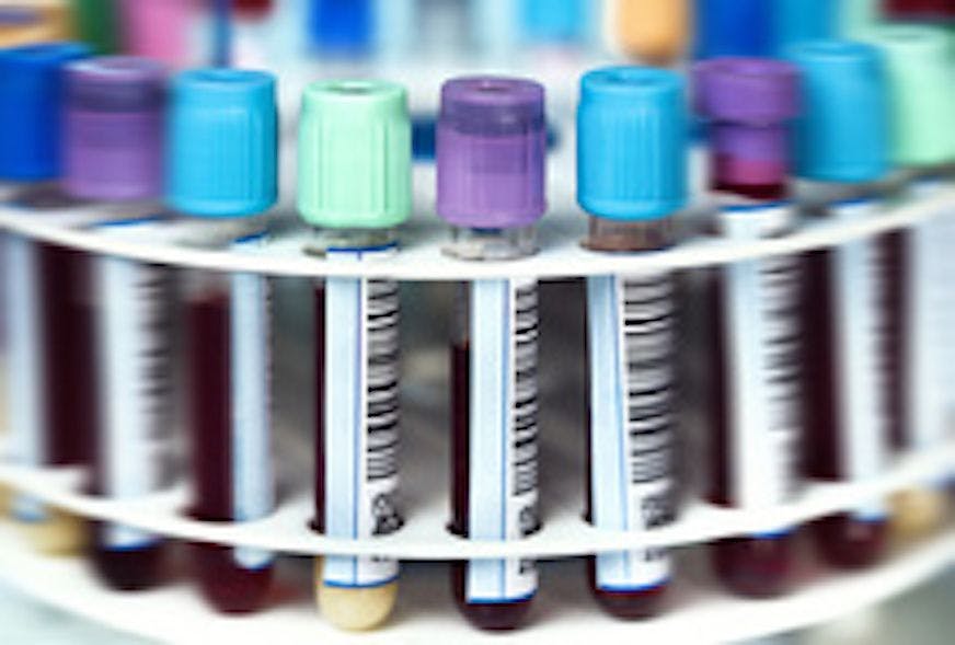 Image of blood-filled test tubes in a centrifuge