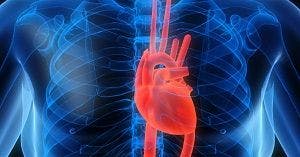 Catheter Ablation More Effective Than Traditional Therapy in Atrial Fibrillation