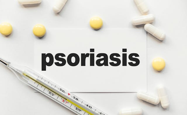 Psoriasis treatment concept | Sviatlana - stock.adobe.com