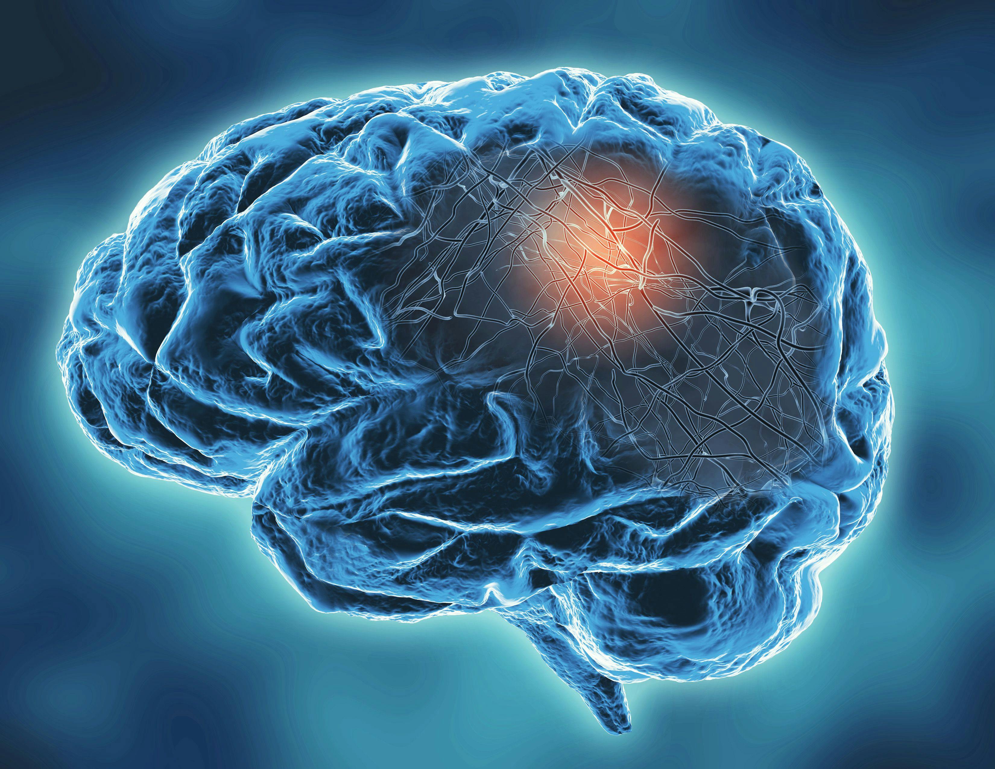 Neurodegenerative Disease Concept | image credit: picture-waterfall - stock.adobe.com