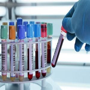 Evidence-Based Guidelines to Reduce Excessive Laboratory Testing