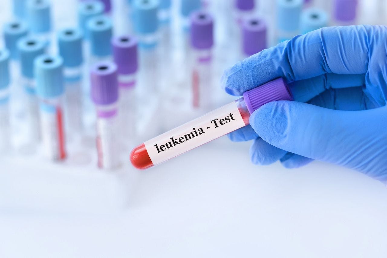 Leukemia test against a background of medical test tubes | Image credit: syhin_stas - stock.adobe.com