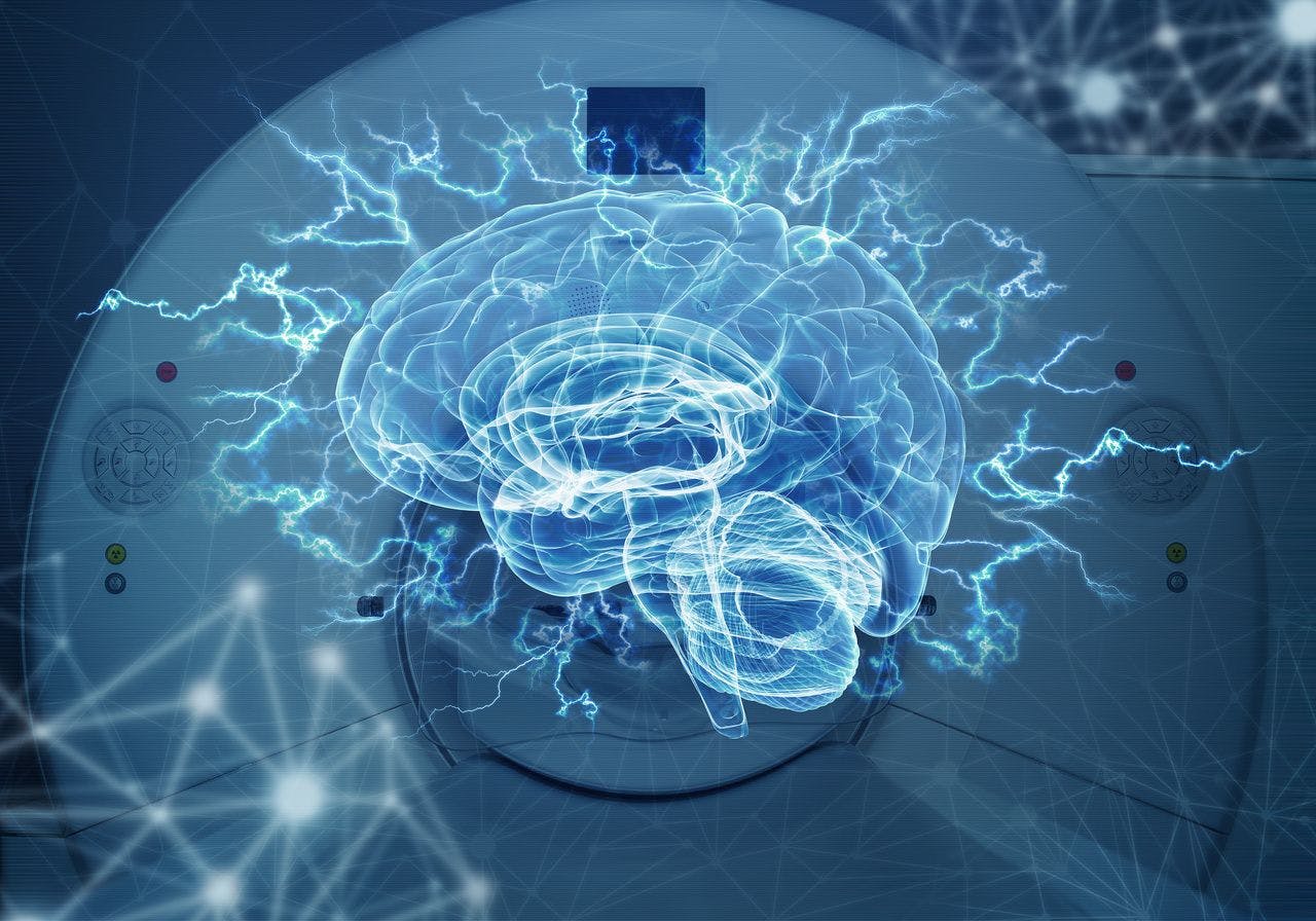 Graphic of brain activity