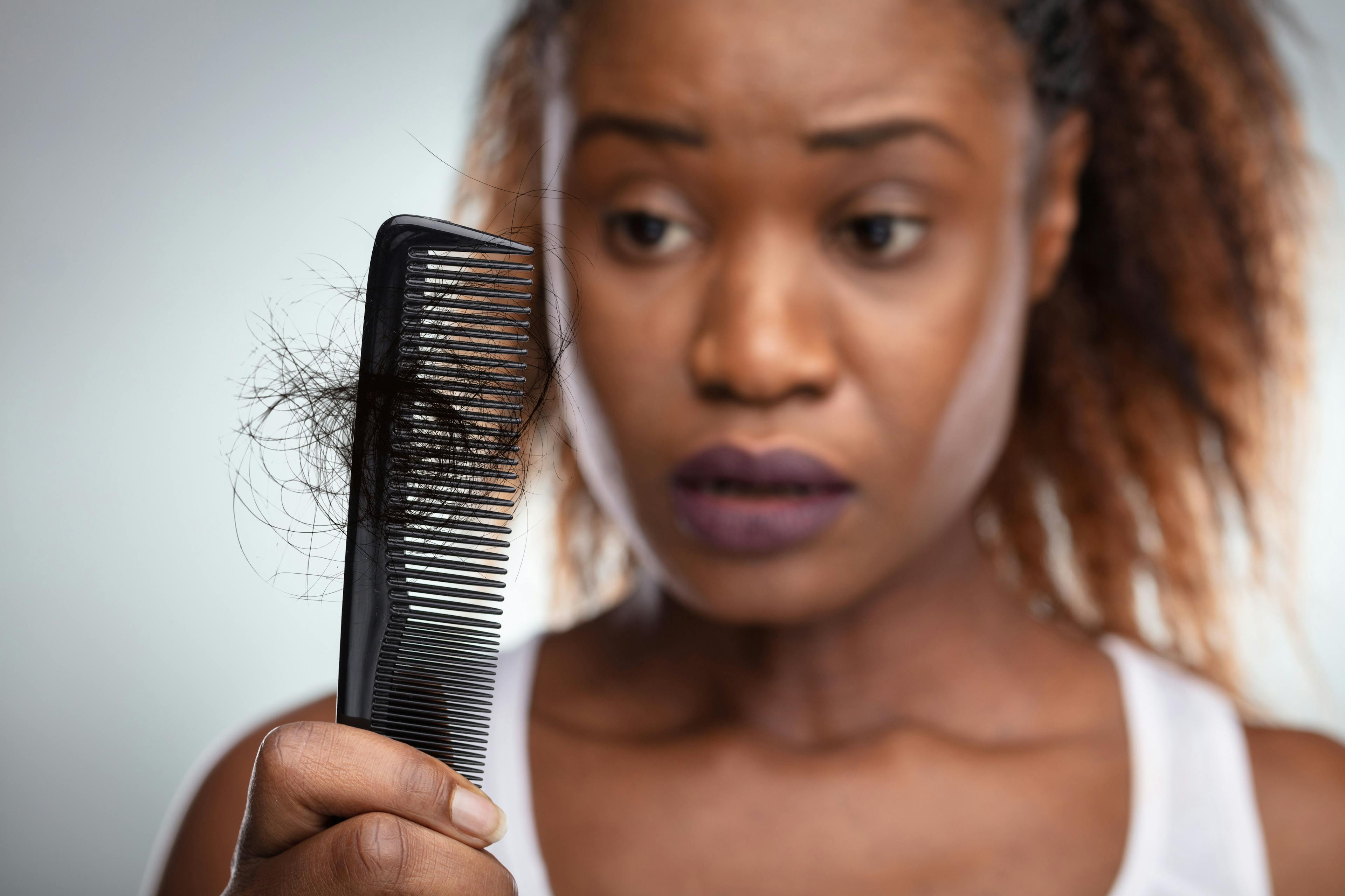 Woman worried about hair loss | Image Credit: Andrey Popov - stock.adobe.com