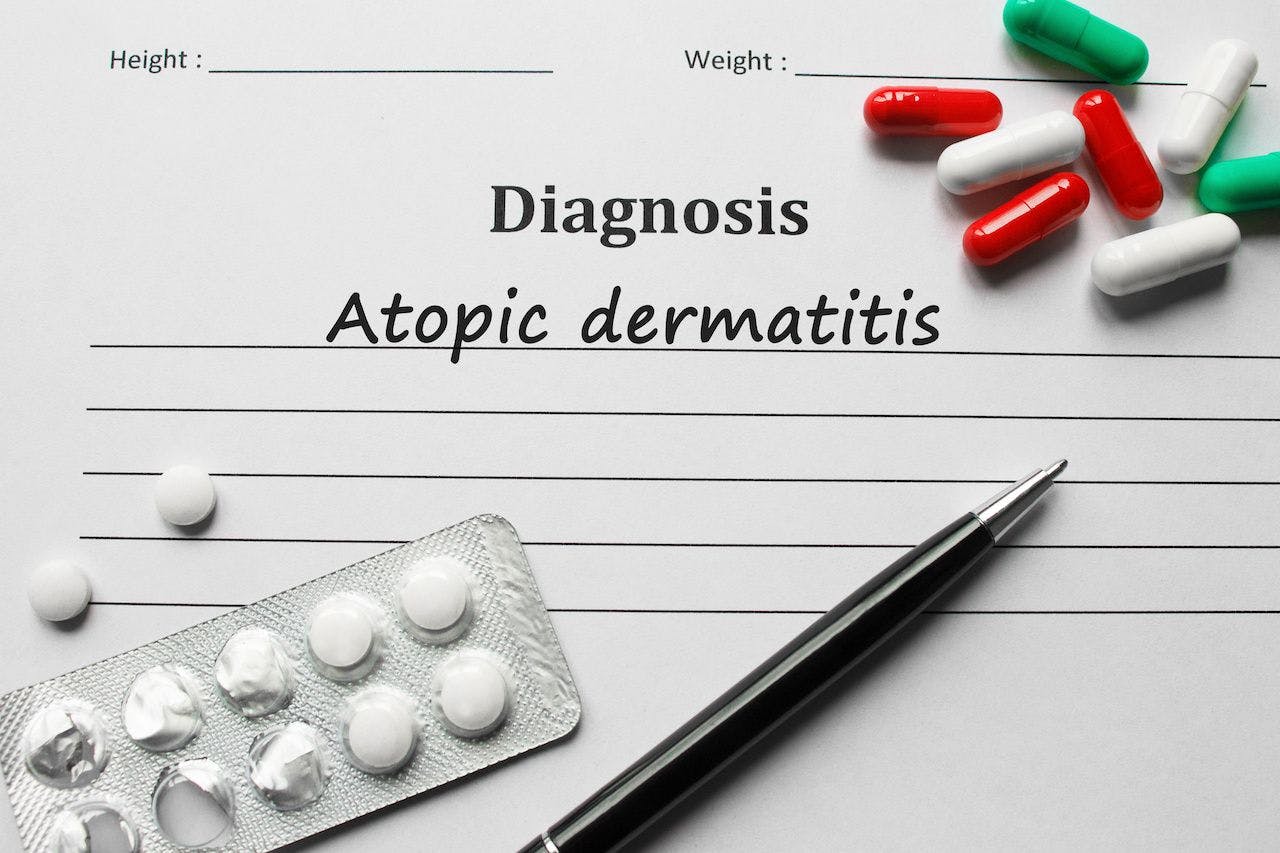 Atopic Dermatitis on the diagnosis list, medical concept: © Michail Petrov - stock.adobe.com