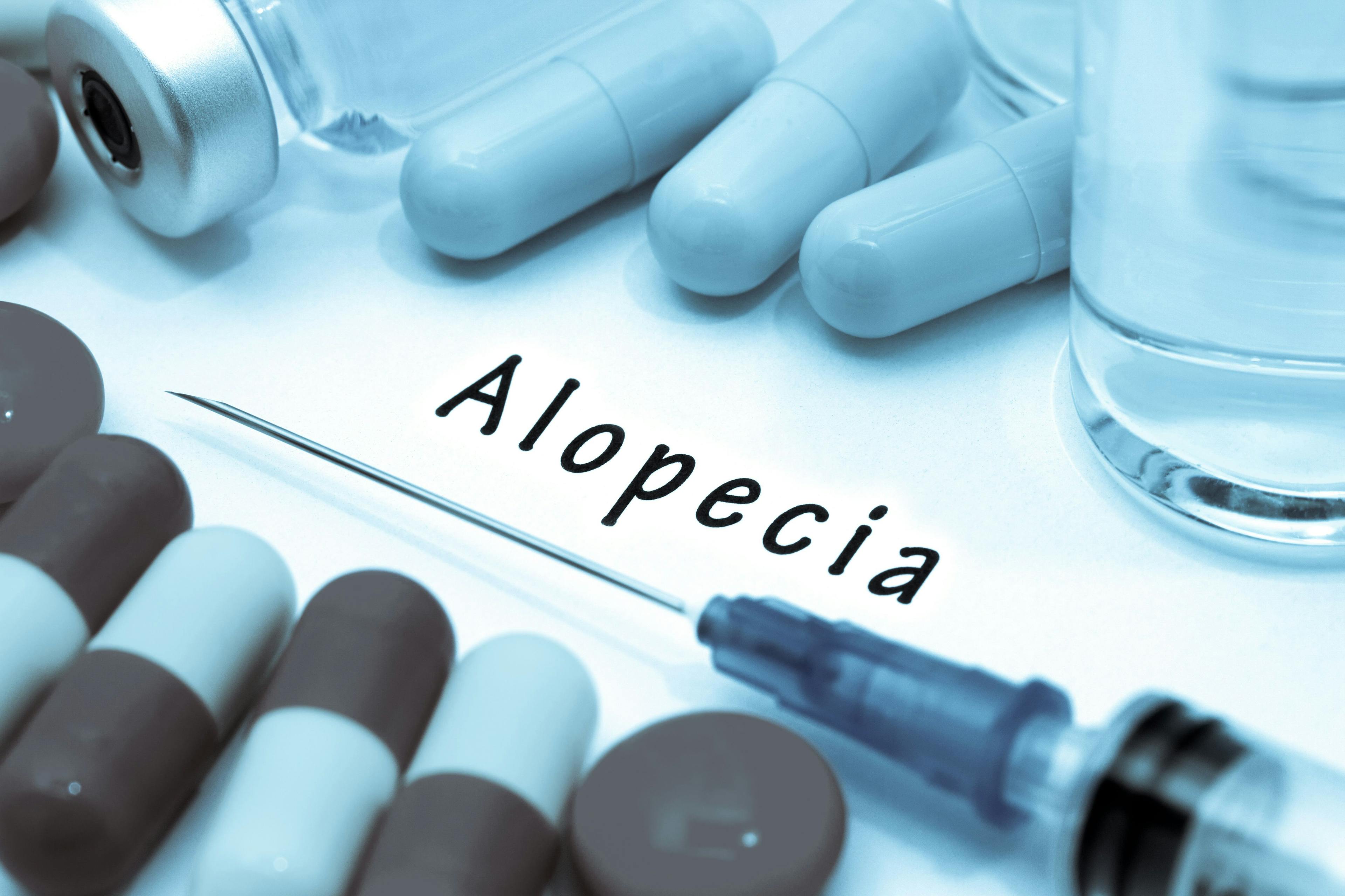 Alopecia surrounded by medication | Image Credit: greenapple78 - stock.adobe.com