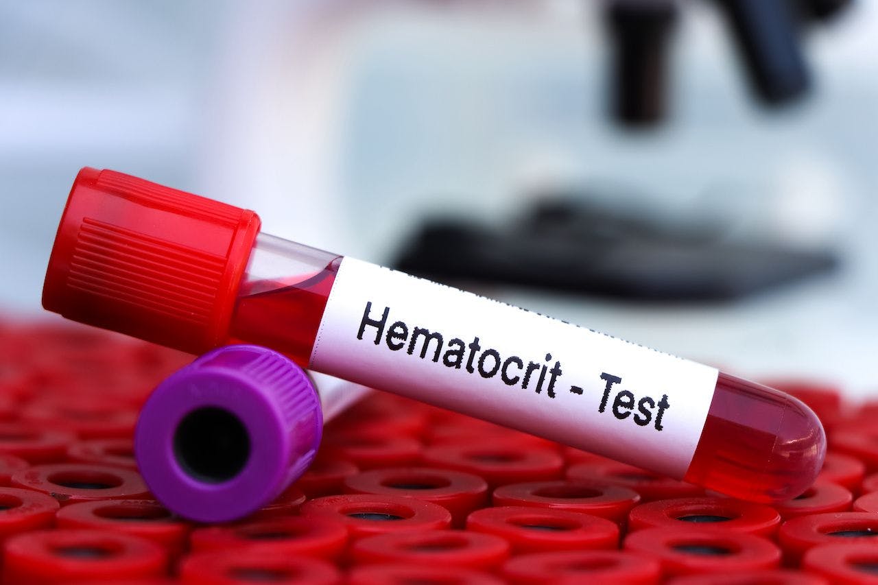 Hematocrit test to look for abnormalities from blood: © kittisak - stock.adobe.com