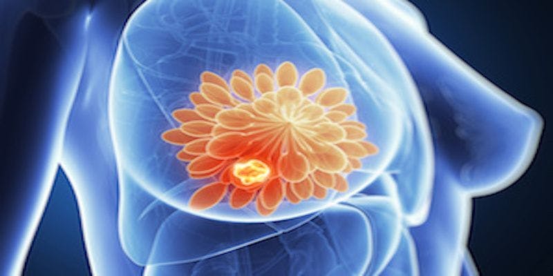 HER2-Positive Breast Cancer Study Finds New Option to Avoid Cardiac Toxicity