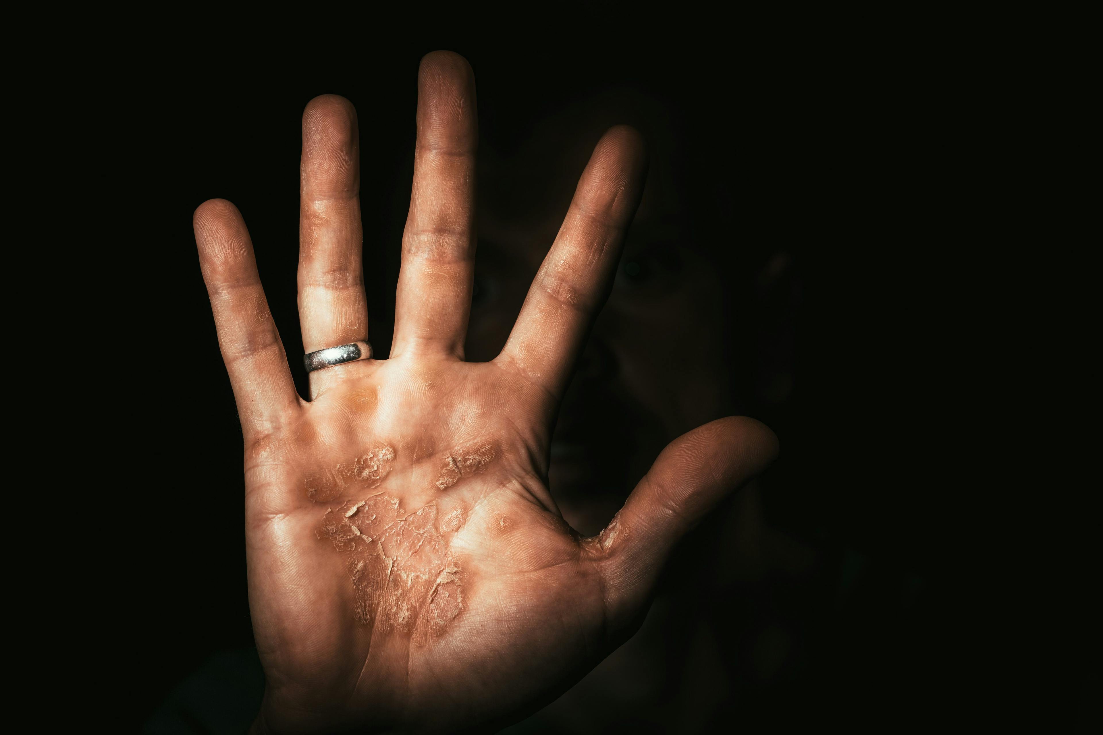 dark hand of a worker with b calluses protests. Stop | vovan - stock.adobe.com