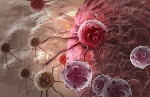 Study Determines Why Patients With HIV Have Higher Rates of Cancer