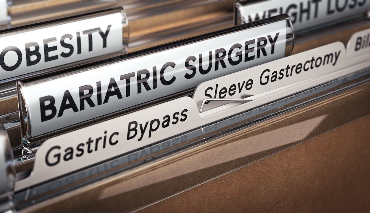 Types of bariatric surgery | Image credit: Olivier Le Moal-stock.adobe.com