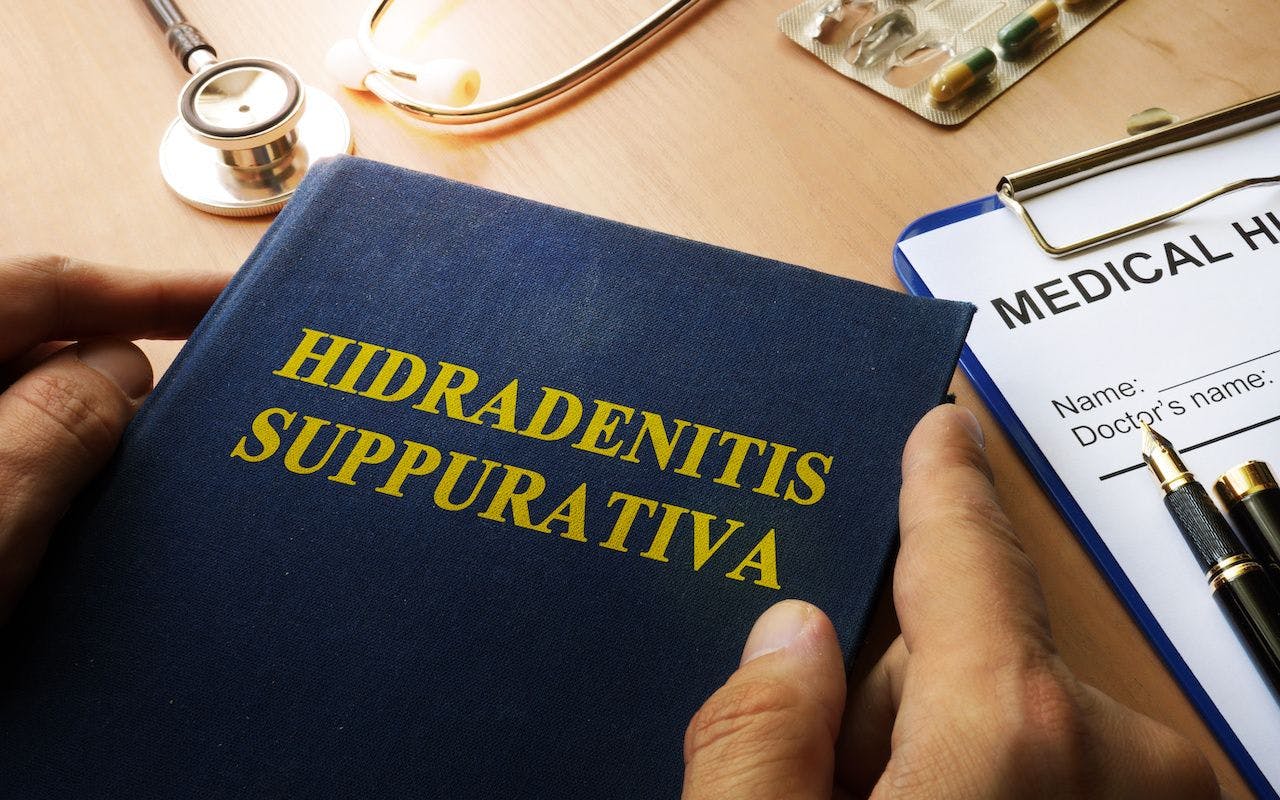 Book with title Hidradenitis Suppurativa on a table: © Vitalii Vodolazskyi - stock.adobe.com