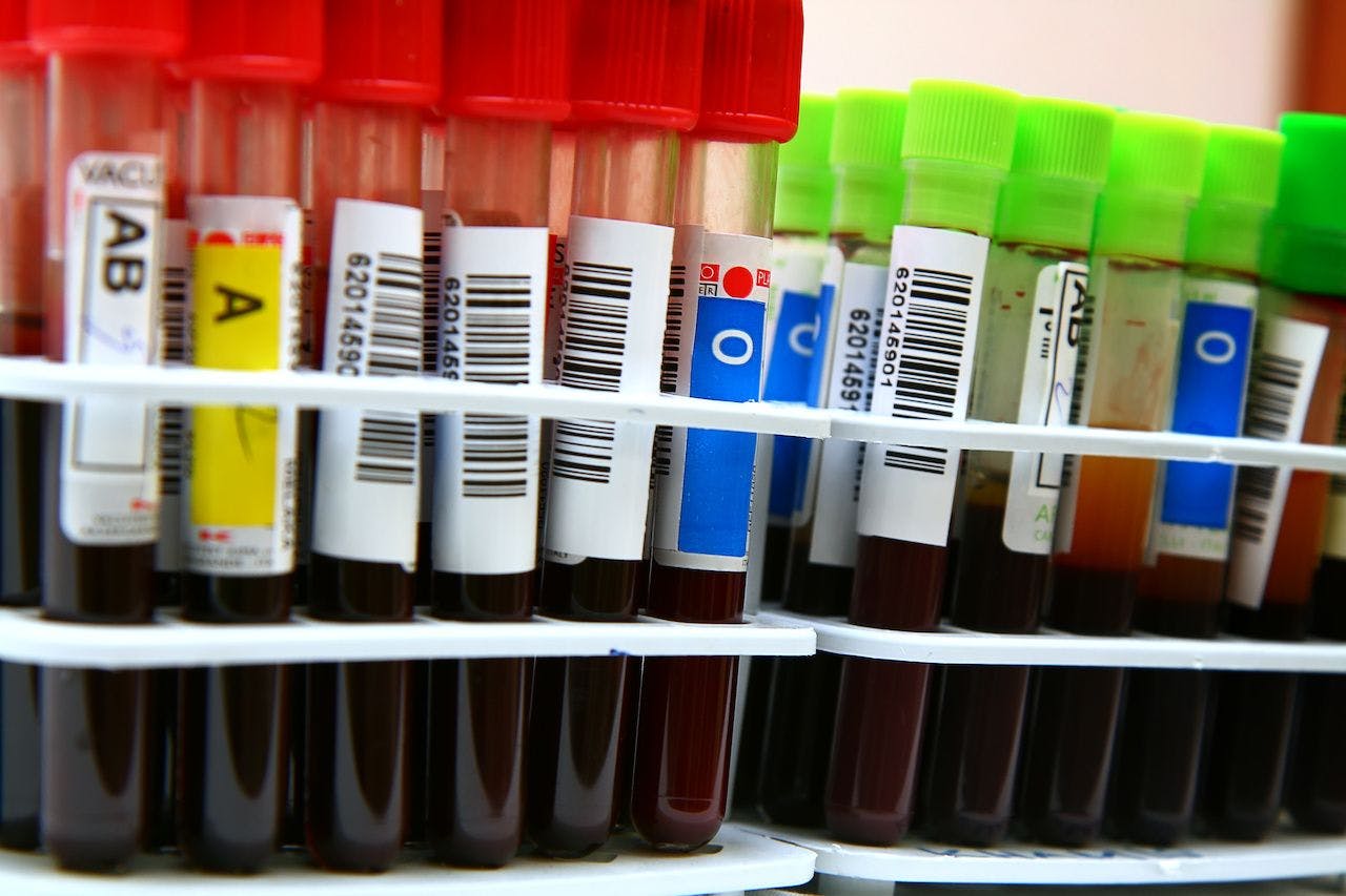 Blood in test tubes