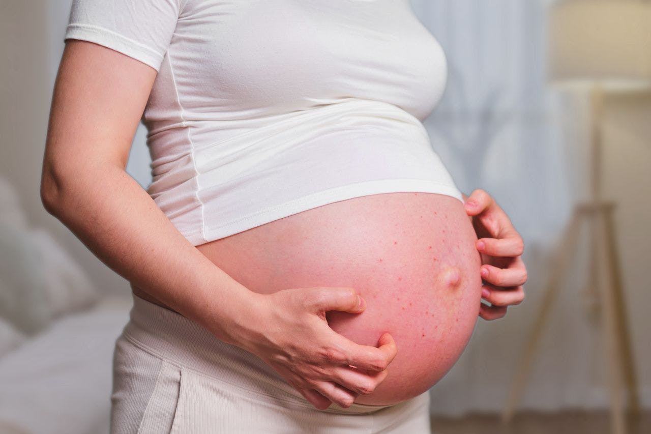Pimples on the belly of a pregnant woman,, home living room: © Андрей Журавлев - stock.adobe.com