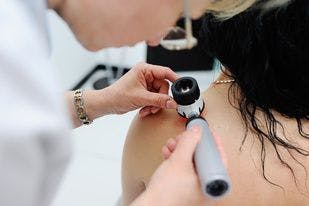 skin cancer examination | Image credit: 