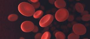 Alternative Ruxolitinib Dosing Regimen May Mitigate Anemia in Patients With Myelofibrosis