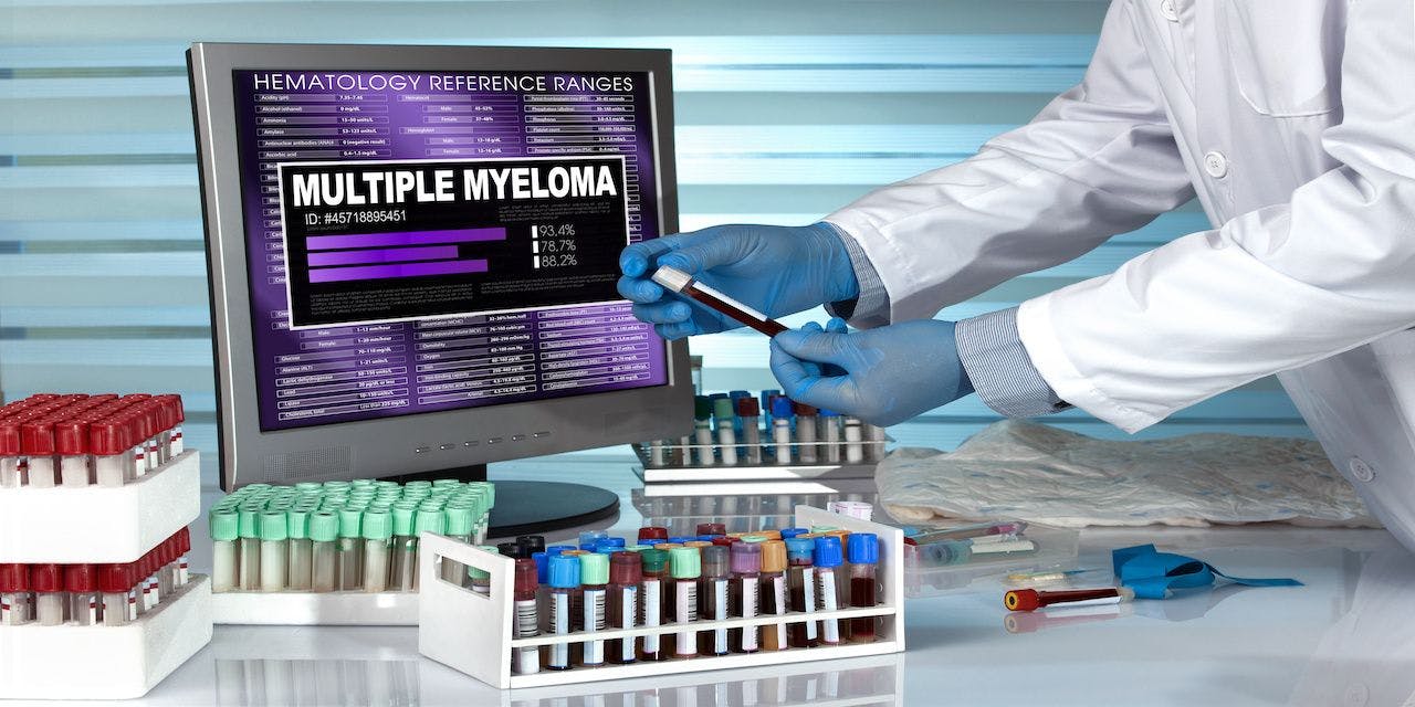 doctor in lab examining blood sample with the text multiple myeloma in screen of computer / technician with blood sample and text multiple myeloma in the software of analysis laboratory: © angellodeco - stock.adobe.com