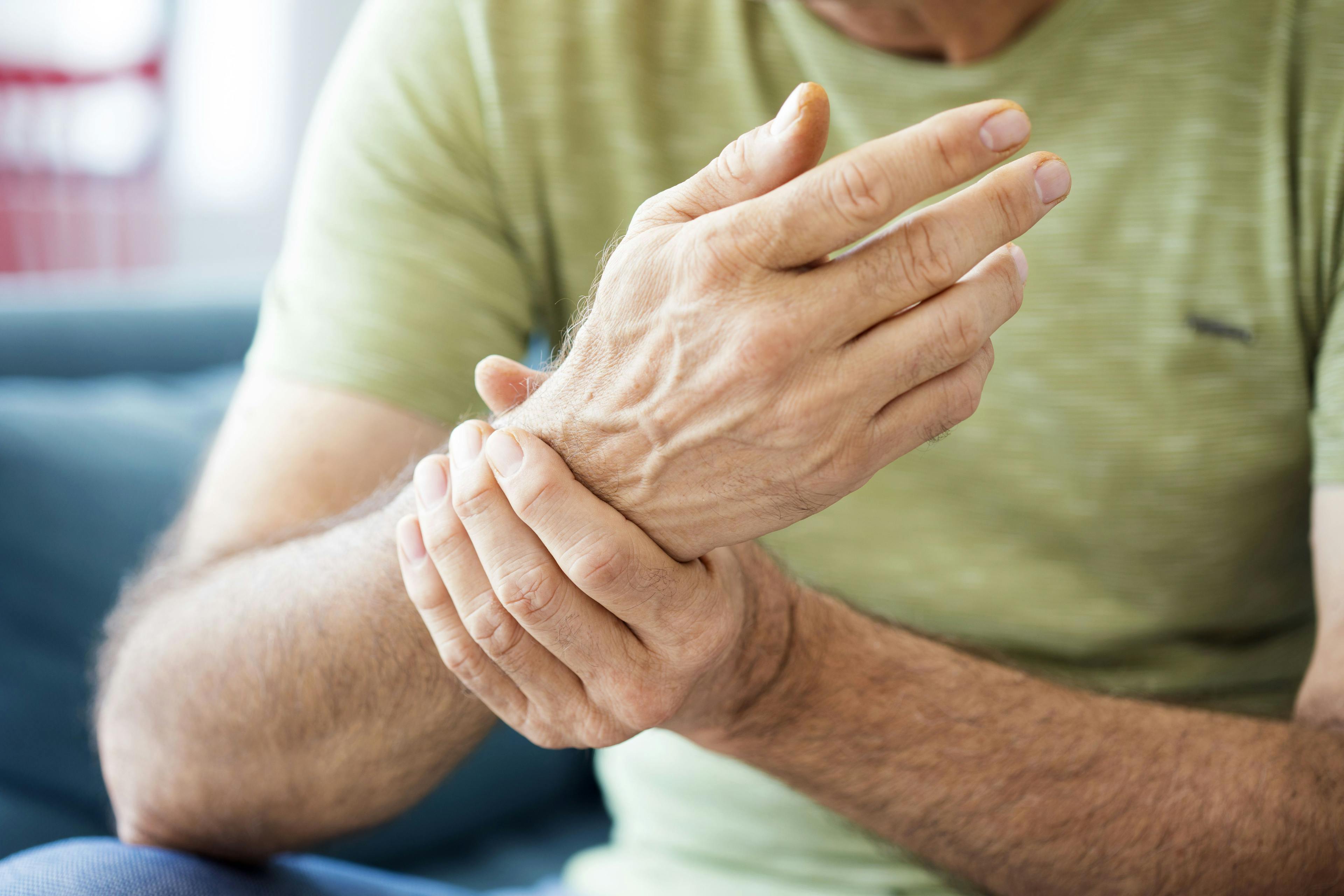 imflammatory arthritis