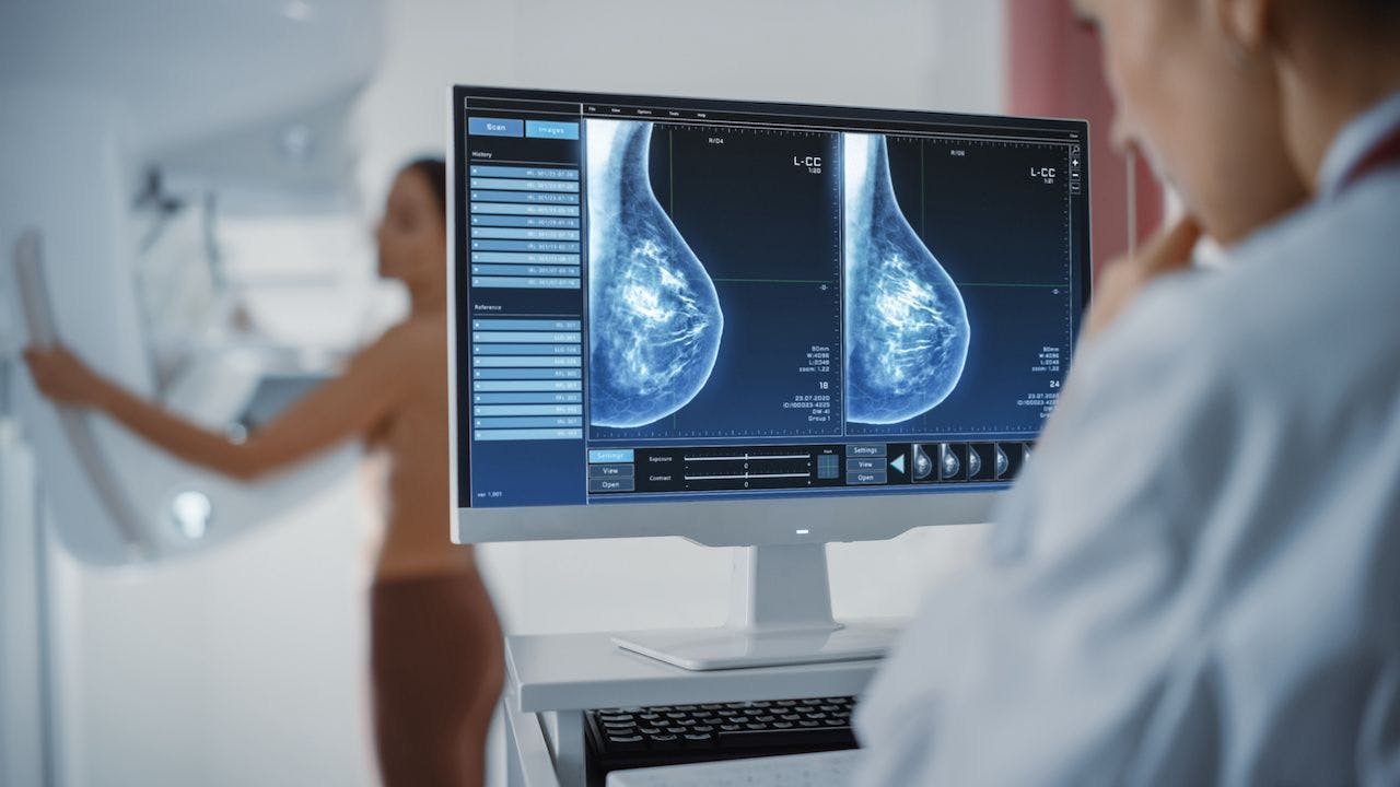 Computer Screen in Hospital Radiology Room: Beautiful Multiethnic Adult Woman Standing Topless Undergoing Mammography Screening Procedure. Screen Showing the Mammogram Scans of Dense Breast Tissues | Image Credit: Gorodenkoff - stock.adobe.com