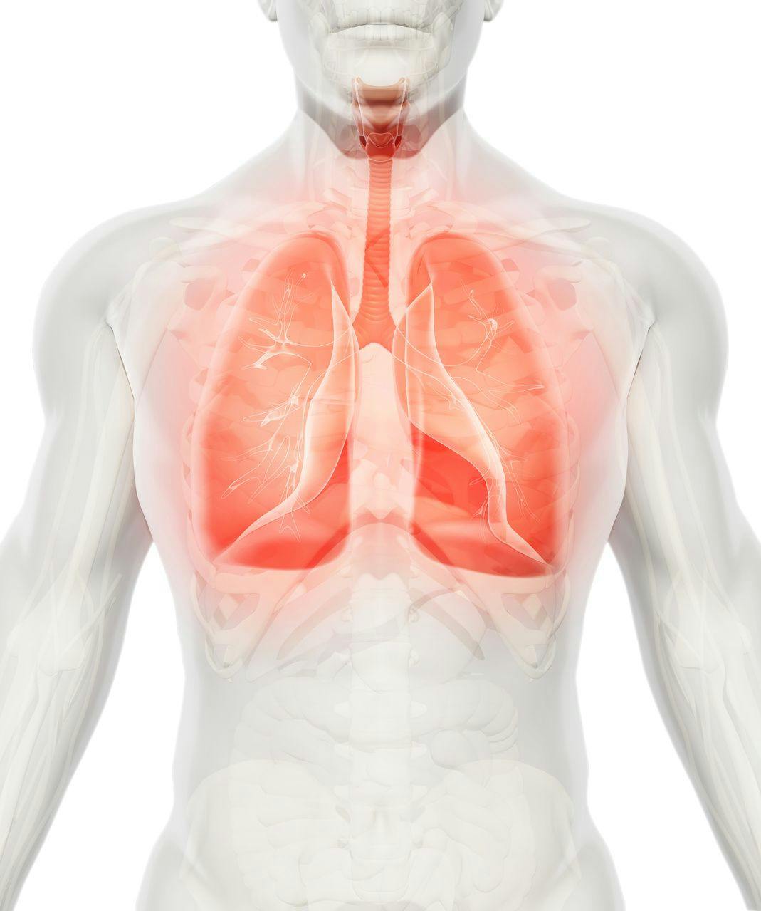 Knowledge About Effective Therapies for Interstitial Lung Disease Lacking, Review Says