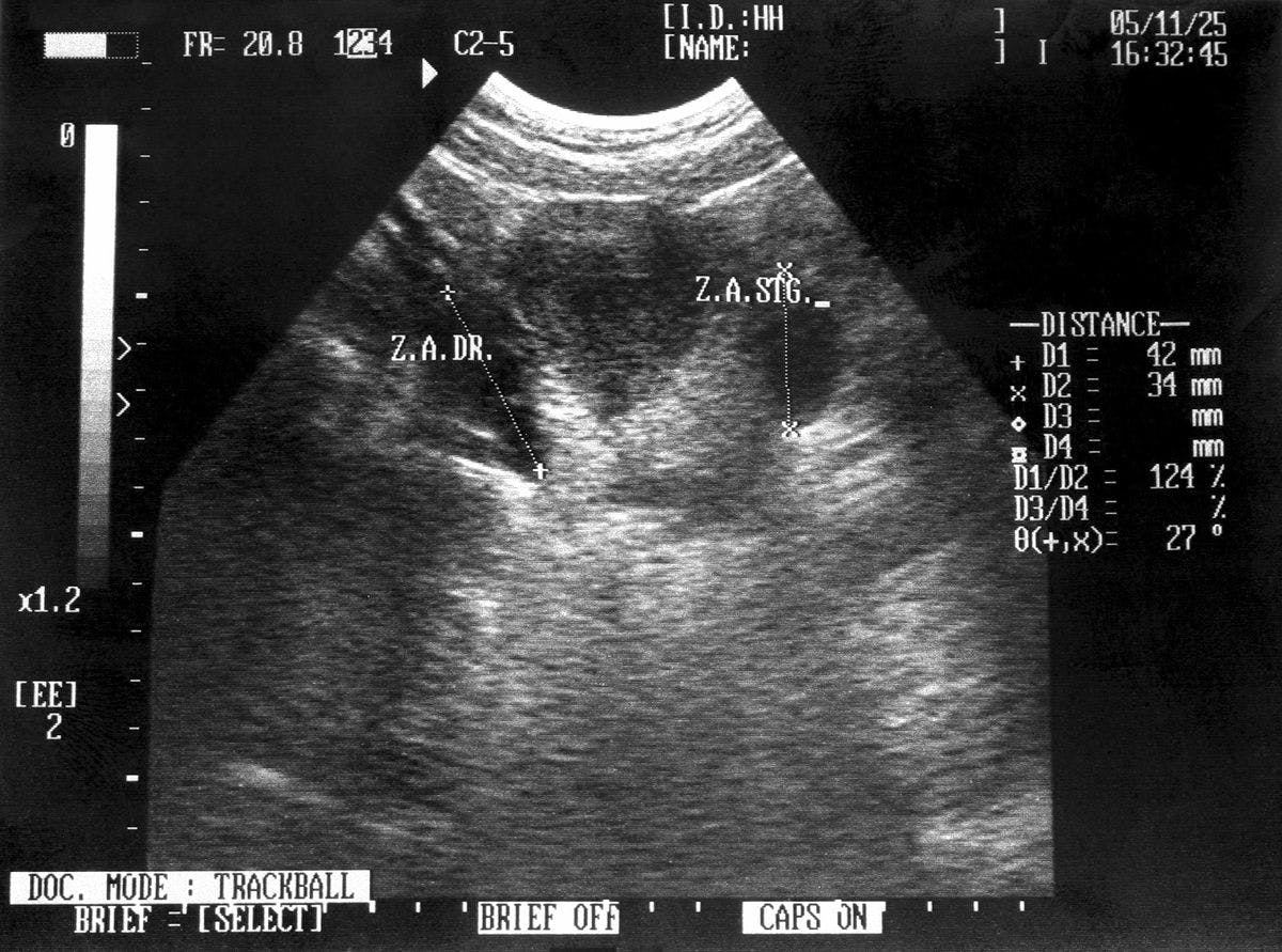 Image of an ultrasound