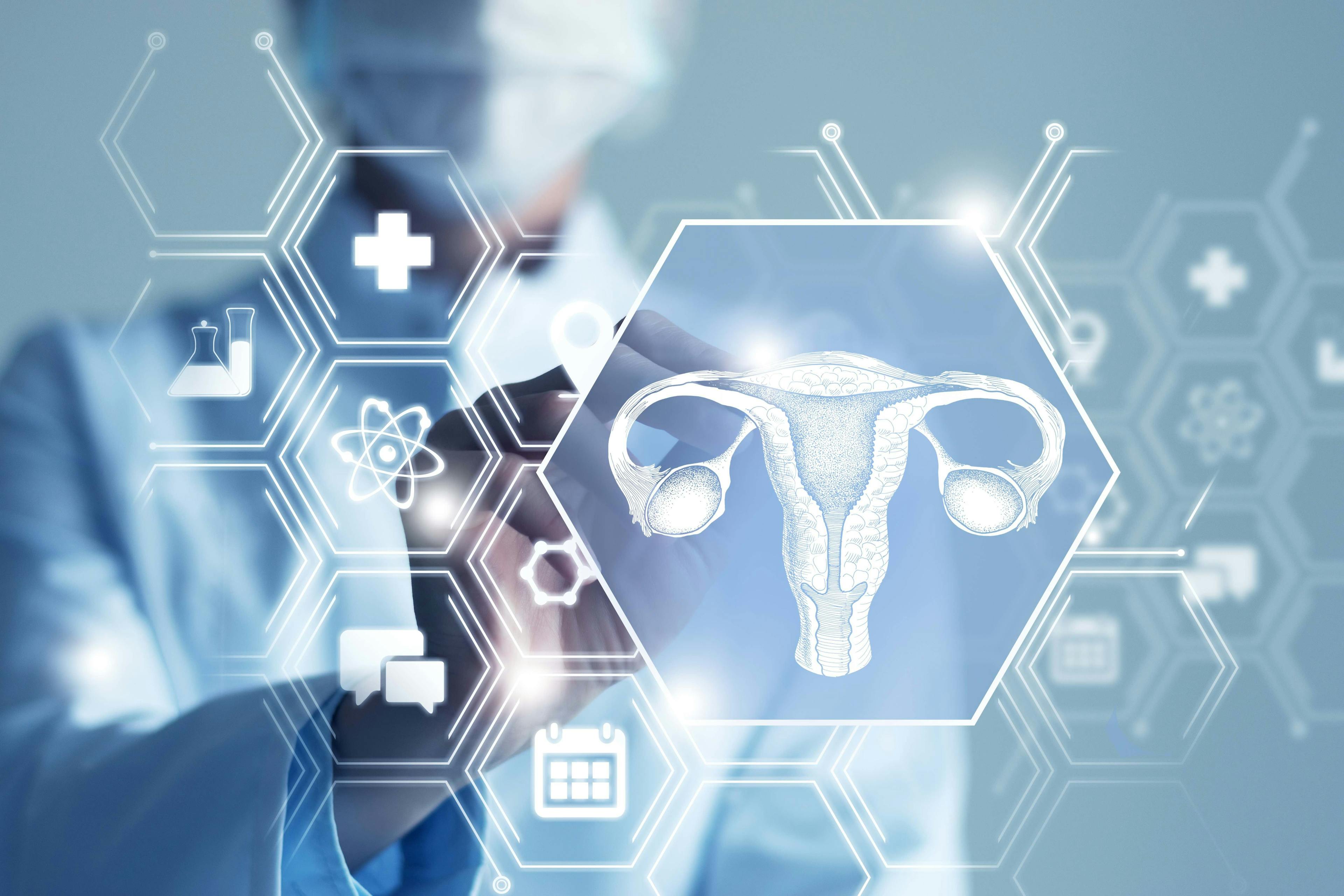 Ultrasonography-Based Ovarian Tumor Risk Models Show High Performance in US Cohort