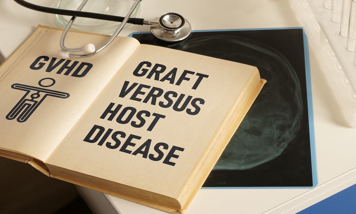 Graft-versus-host disease | Image Credit: Andrii - stock.adobe.codm