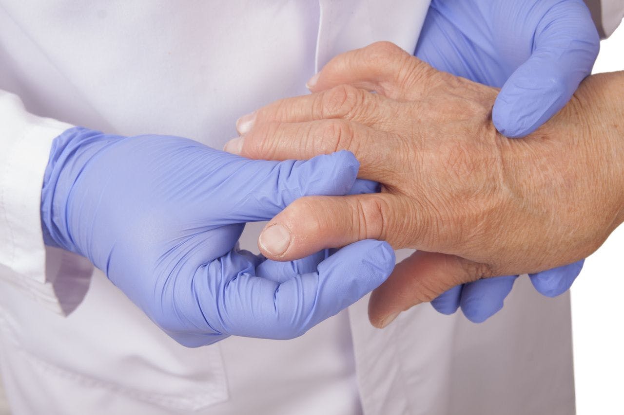 Doctor examining hand of patient with rheumatoid arthritis