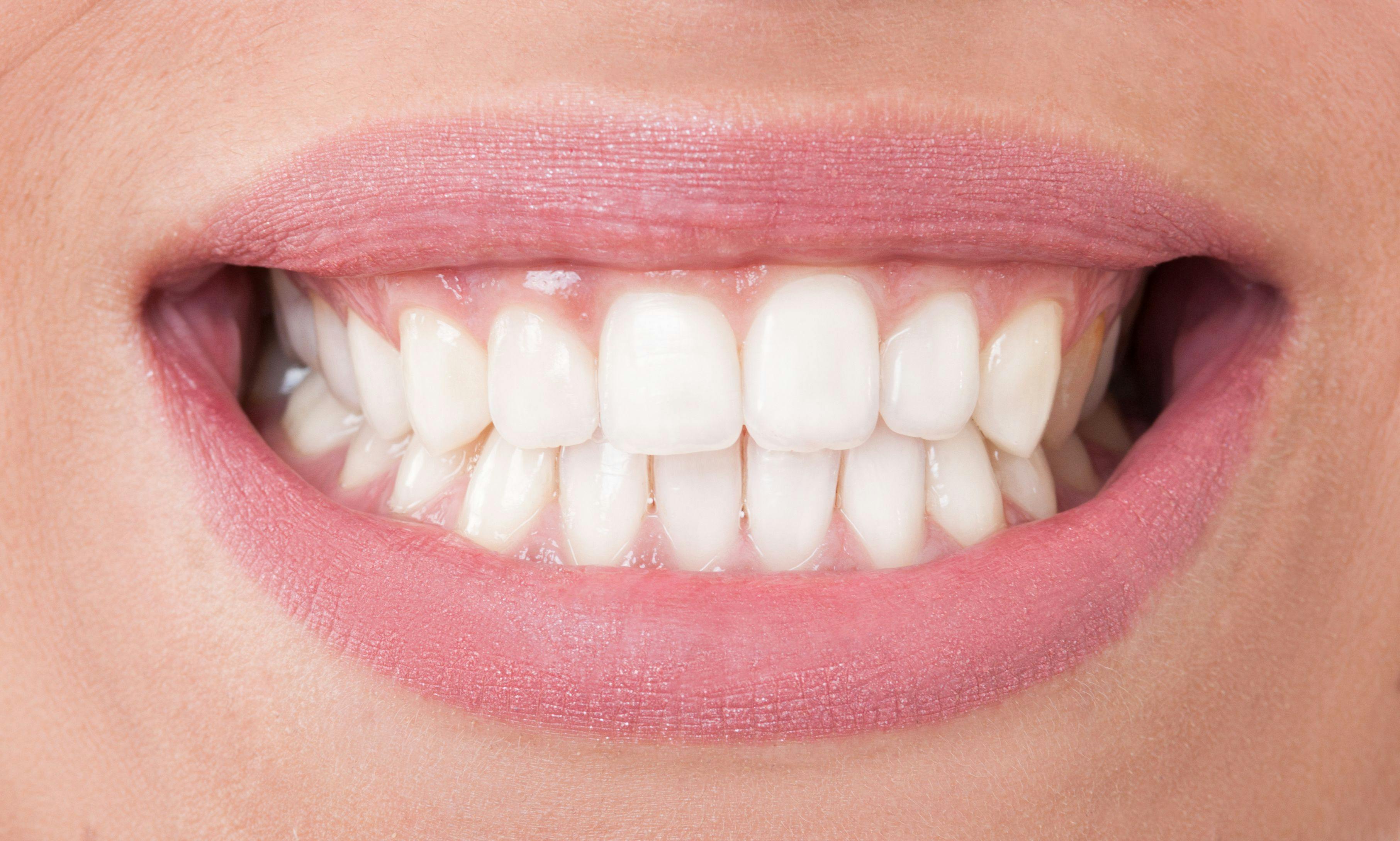 Close up of teeth | Image credit: Catalin Pop - stock.adobe.com