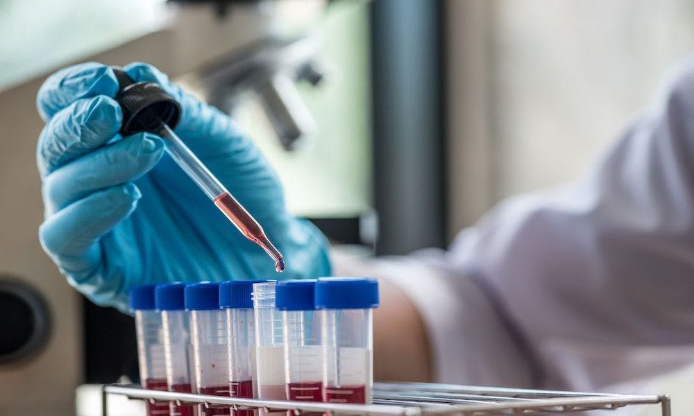 A scientist is adding blood to vials