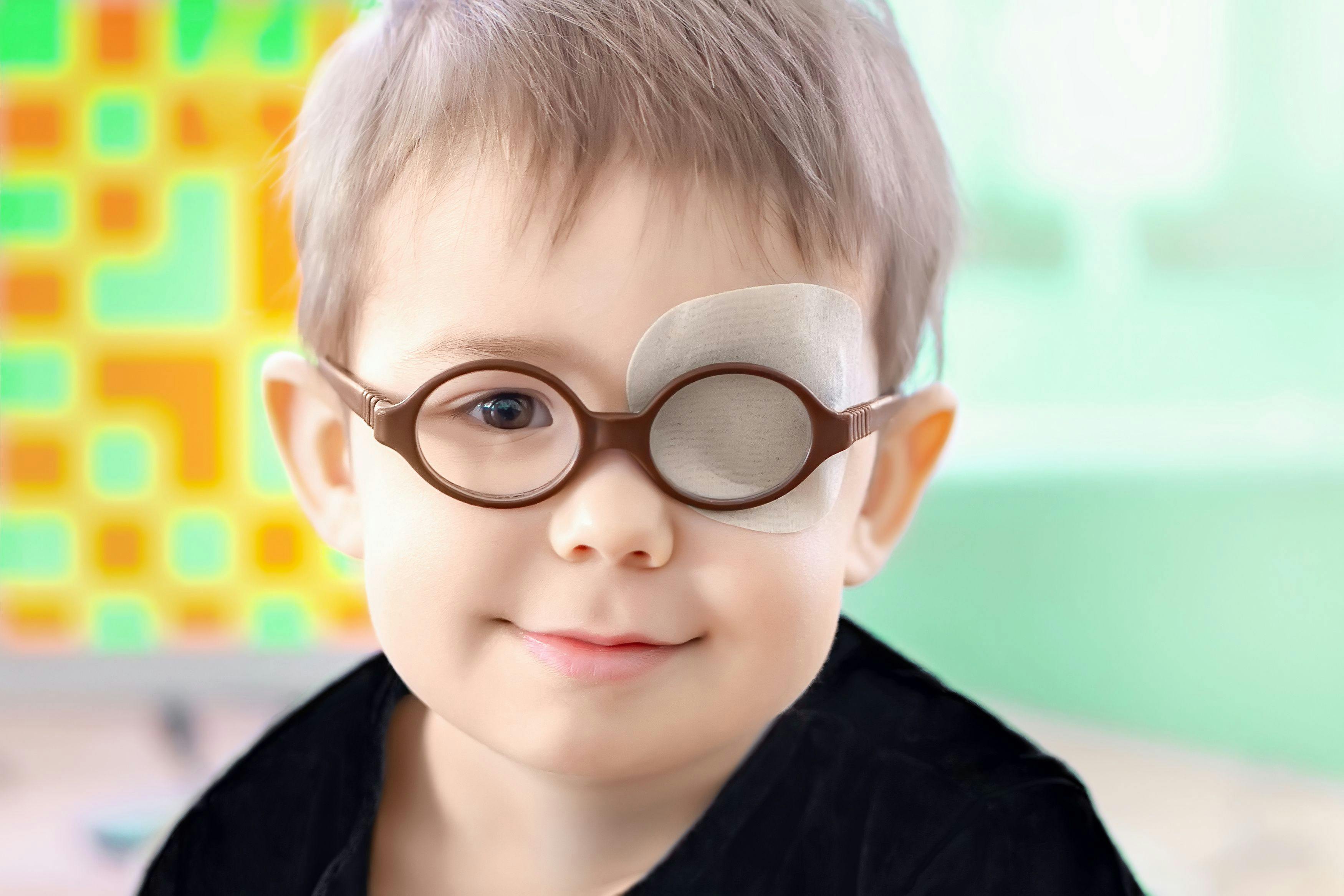 Young child with eye patch | Image credit: Maxim Kukurund - stock.adobe.com