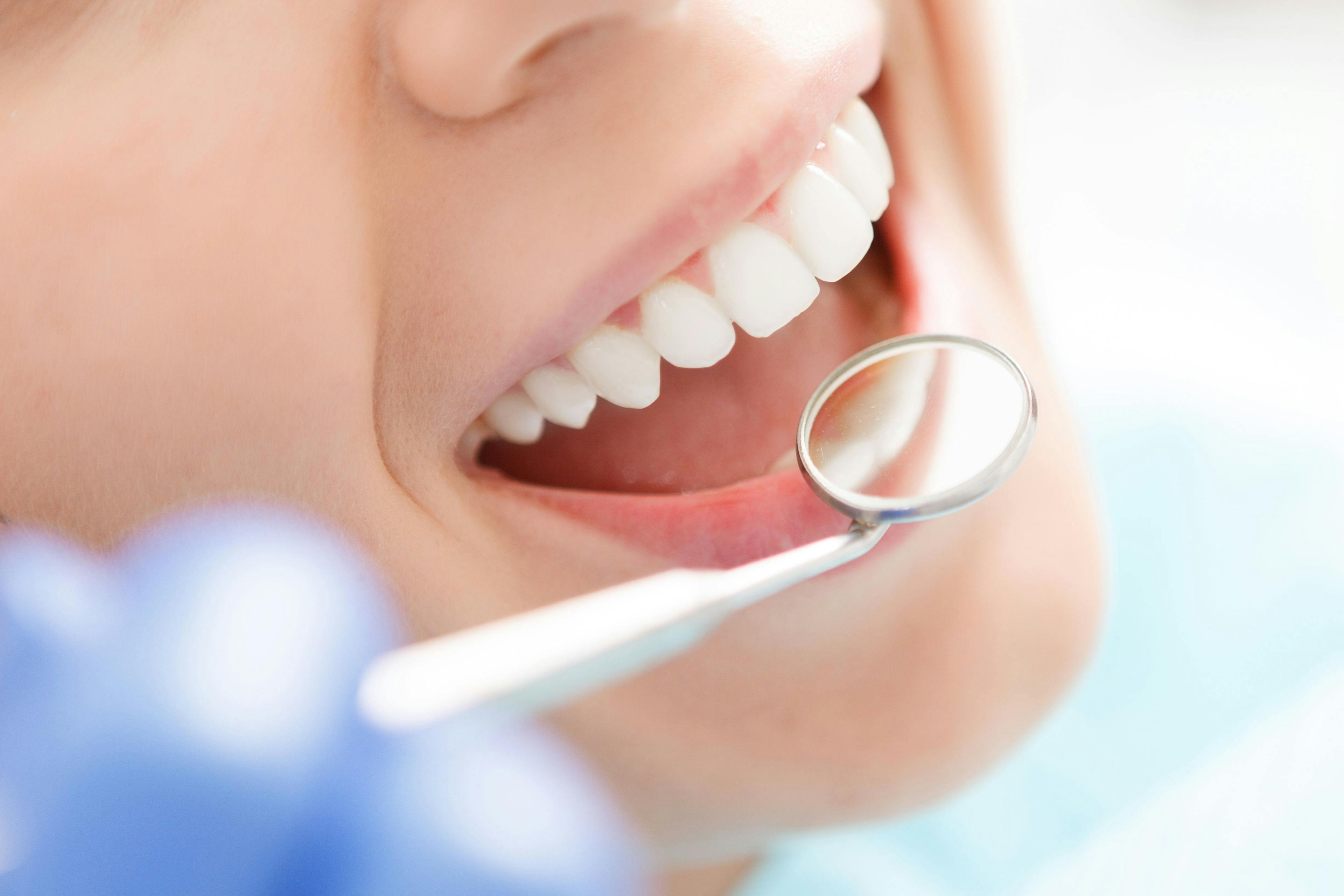 woman at dentist, close-up of teeth with dental tool