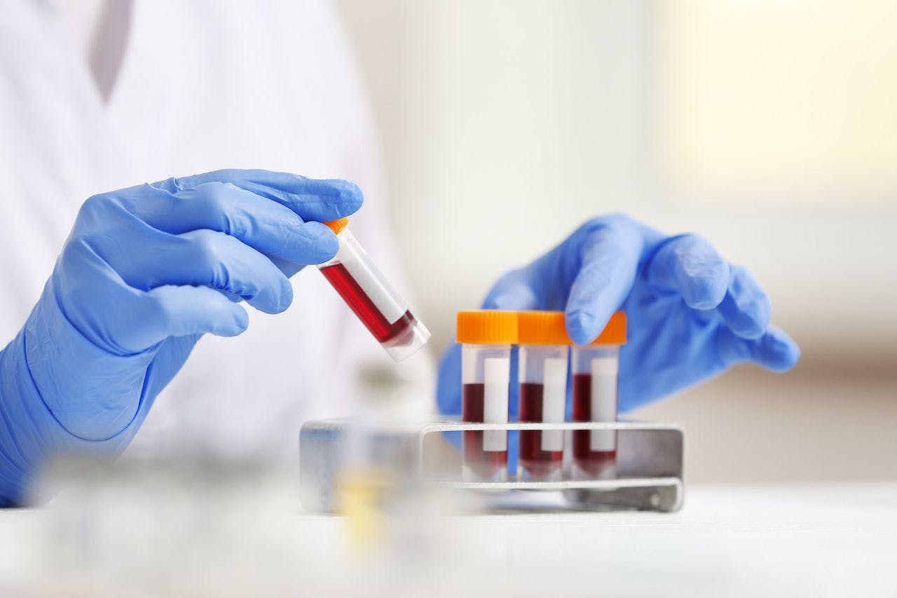 Lab tech holding blood samples: Africa Studio - stock.adobe.com