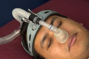 Screen Patients With Psoriasis for Obstructive Sleep Apnea, Researchers Say