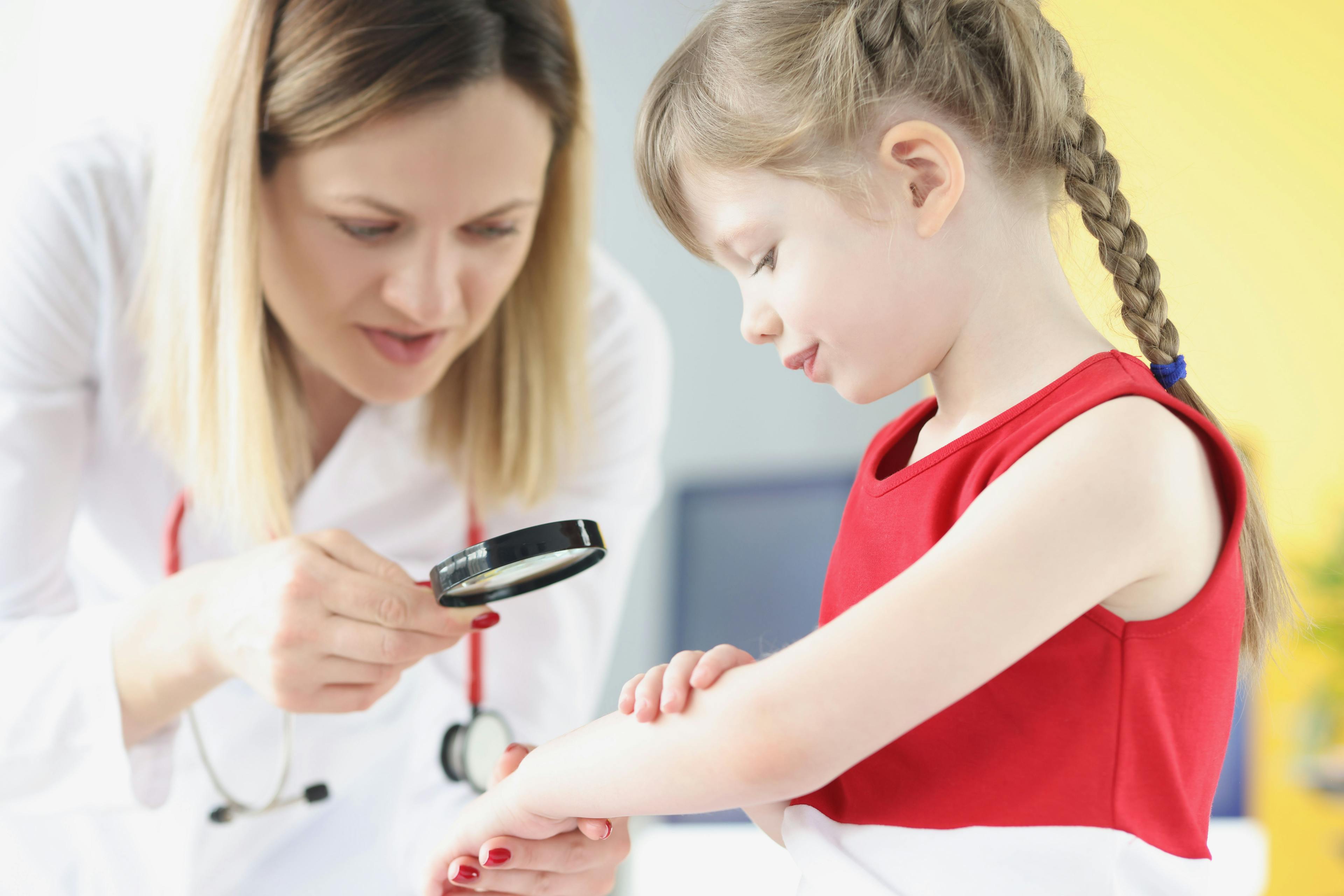 doctor treating child for AD