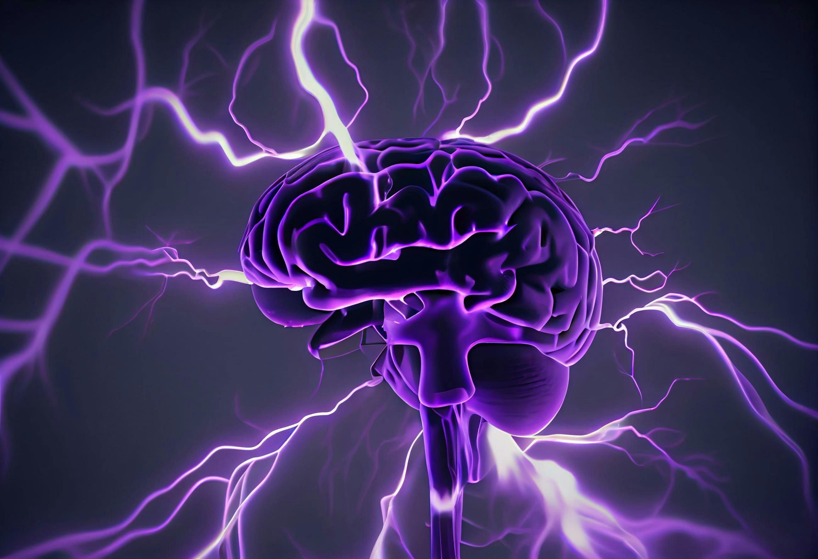 Epilepsy awareness concept. Brain and encephalography in epilepsy patient during seizure attack, 3D illustration in purple color. Generative AI | Image credit: Ahmed - stock.adobe.com
