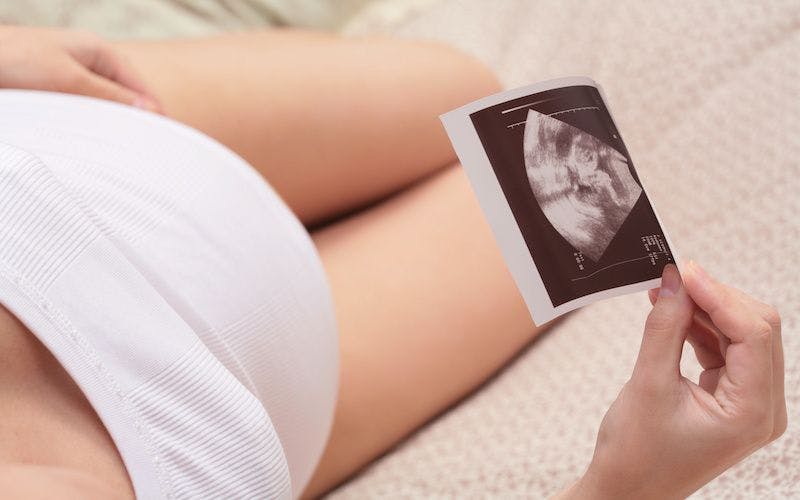pregnancy, ultrasonic portrait of the fetus: © Astroid - stock.adobe.com