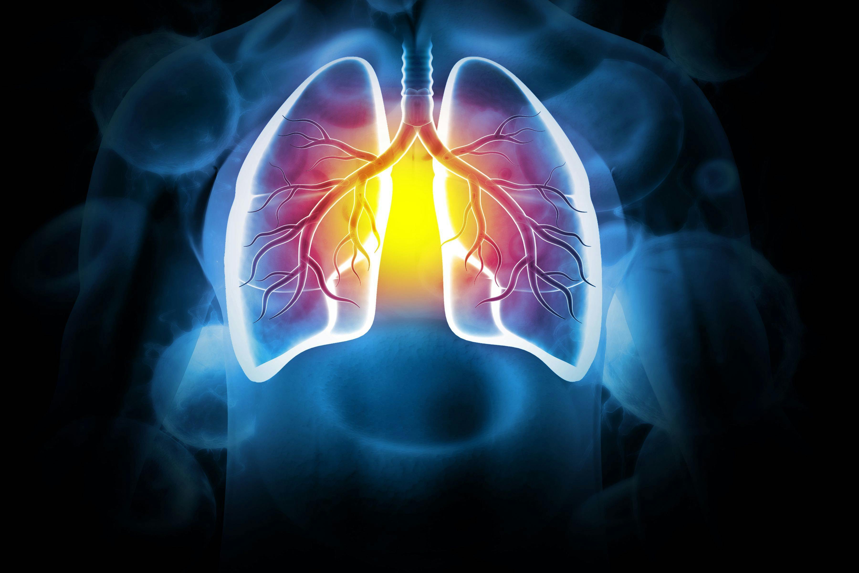 Lung disease | Image credit: Crystal light - stock.adobe.com