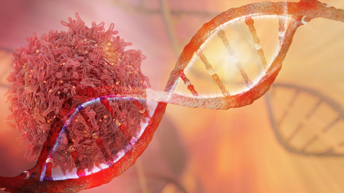 Circulating Cell-Free DNA Could Be Marker of Progression in Multiple Myeloma