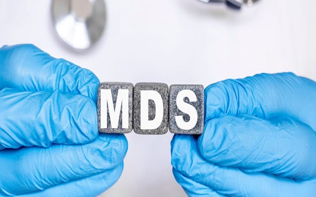 MDS Myelodysplastic syndrome | Image Credit: © Sviatlana - stock.adobe.com.jpeg
