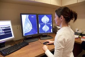 Geography Influences Type of Posttreatment Imaging Received After Early Breast Cancer