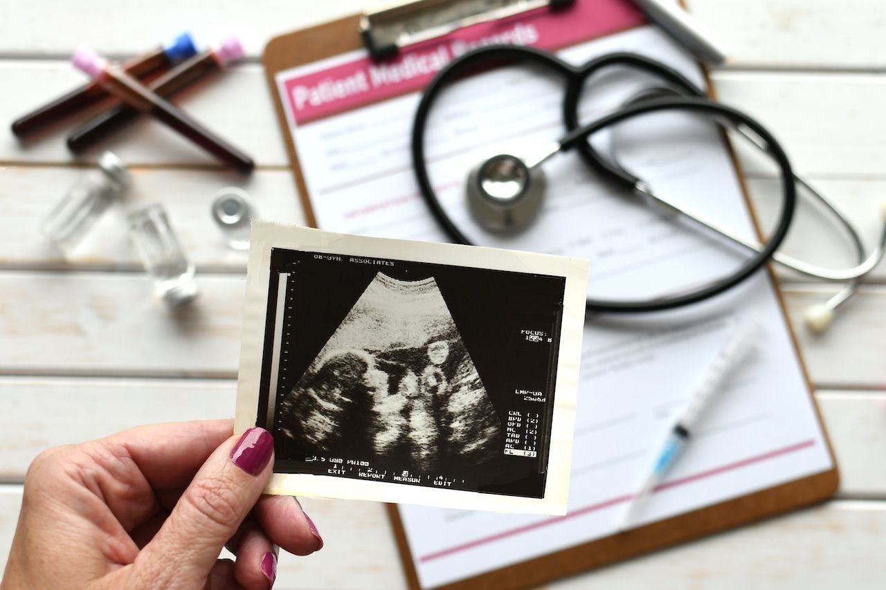 Prenatal medical care | Image credit: MargJohnsonVA - stock.adobe.com