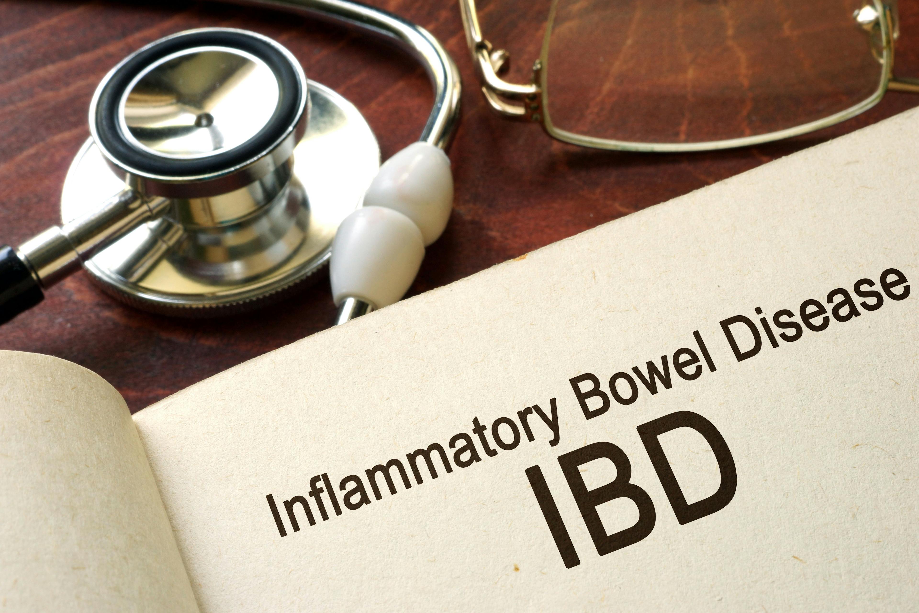 inflammatory bowel disease (IBD) written on a paper with a stethoscope | Image Credit: Vitalii Vodolazskyi - stock.adobe.com