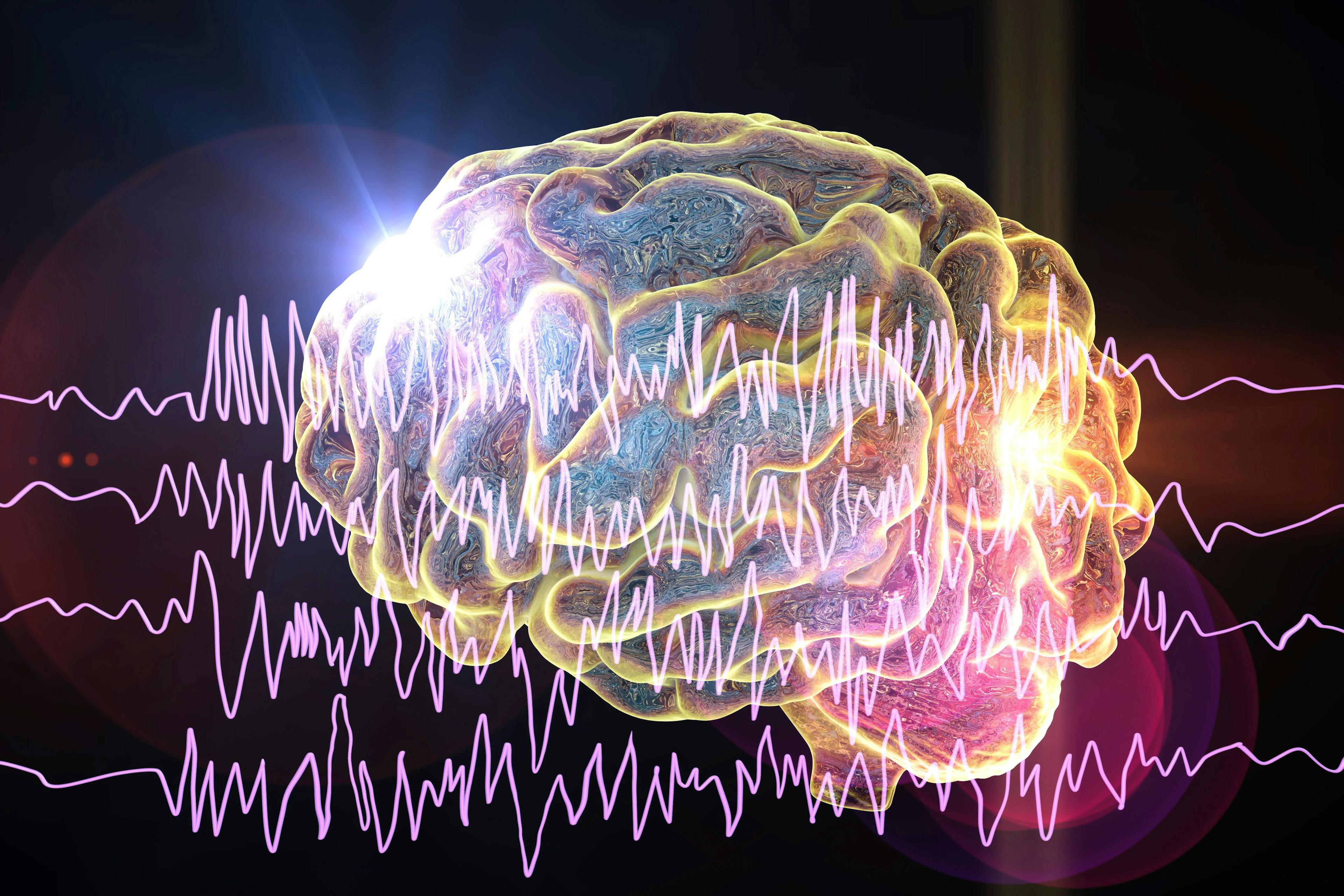 brain with epilepsy | Image credit: Dr_Microbe - stock.adobe.com
