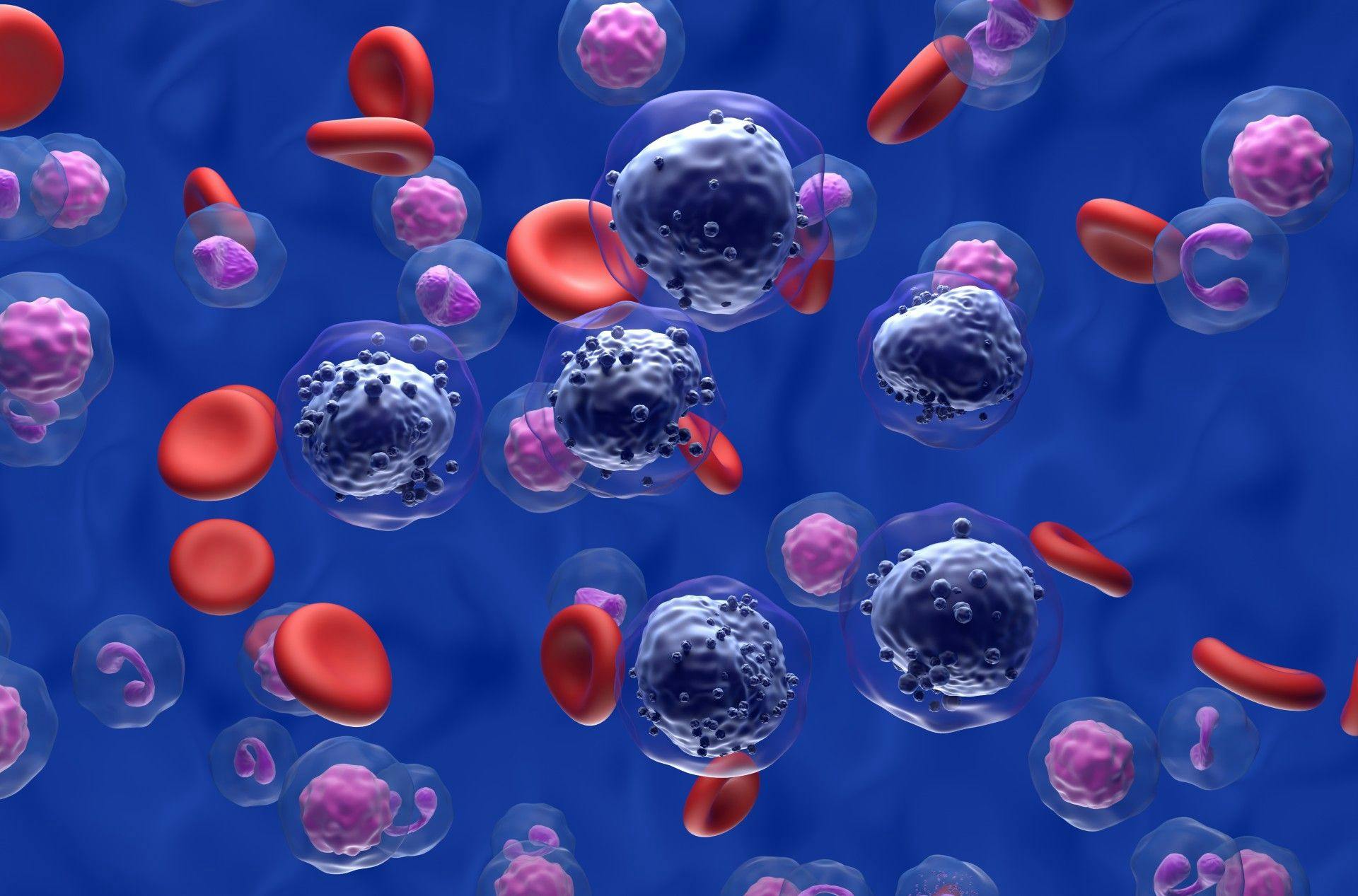 Acute lymphoblastic leukemia cancer cells in blood flow | Image credit: LASZLO - stock.adobe.com
