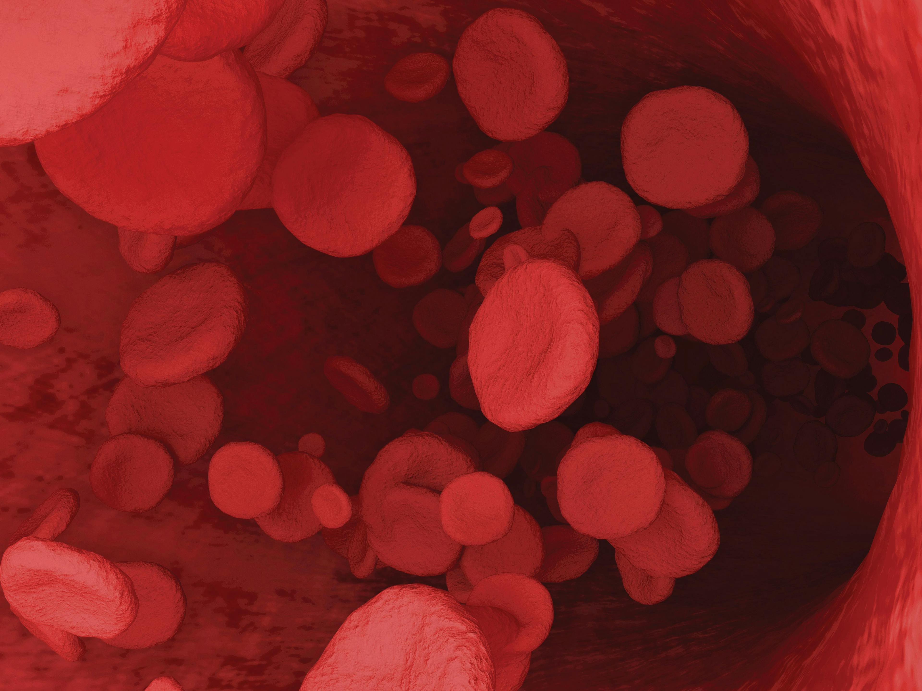 Study Explores Causes of Bleeding in Patients with CLL, MCL Taking Ibrutinib