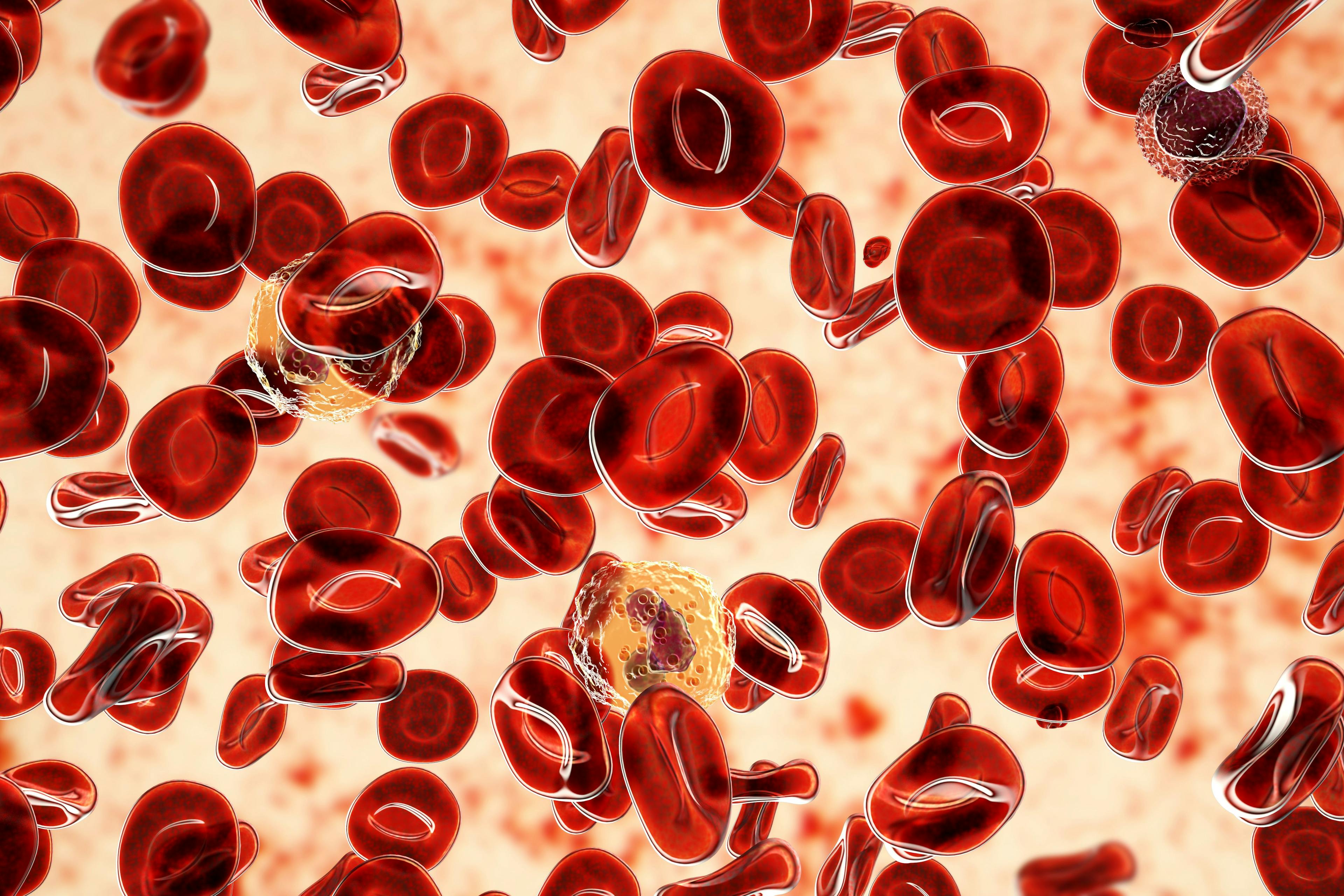 Polycythemia vera, a rare slow-growing blood cancer with an increase in the number of red blood cells | Dr_Microbe - stock.adobe.com