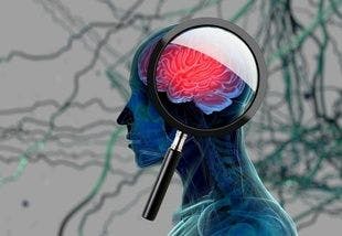 Headache Disorders Associated With Risk of All-Cause Dementia